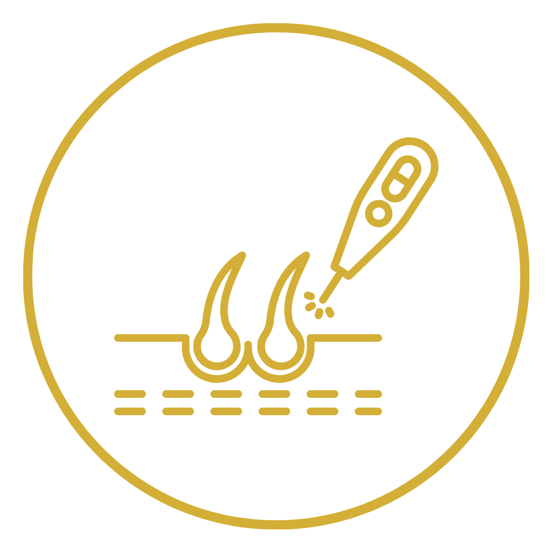 إزالة الشعر بالليزر